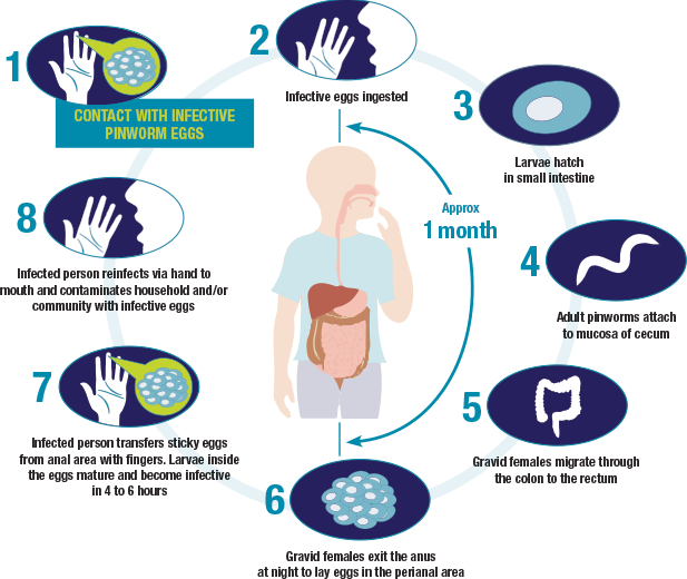 About Pinworm Infection (Enterobiasis)—Facts and Life Cycle