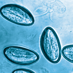 Pinworm eggs are microscopic.